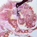 Image client Milieu de coulée Liquitex 946 ml